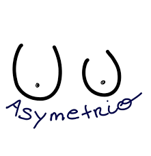 Logo Asymétrio
